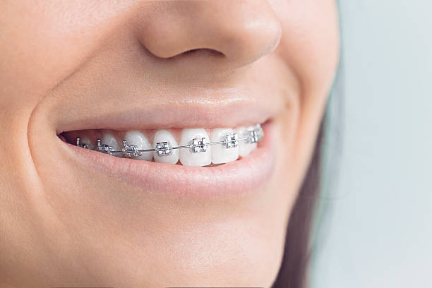 Best Traditional Braces  in Horizon West, FL